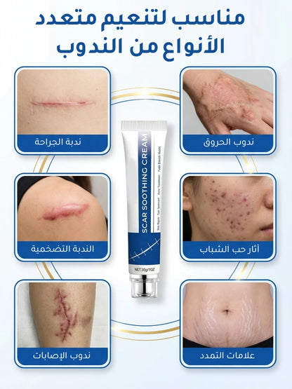 جل السيليكون الطبي لإصلاح الندبات وتخفيف الاحمرار والبروز