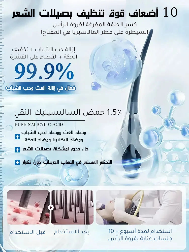 【التخلص من سعفة فروة الرأس العنيدة في 3 أسابيع】شامبو طبي مضاد للبكتيريا والعث