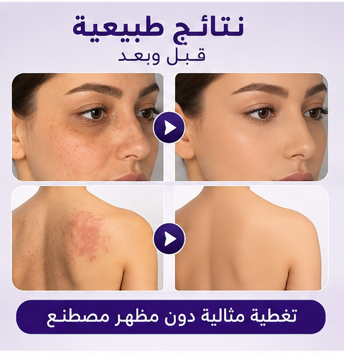 كريم إخفاء العيوب الفوري | بشرة صافية في ثوانٍ