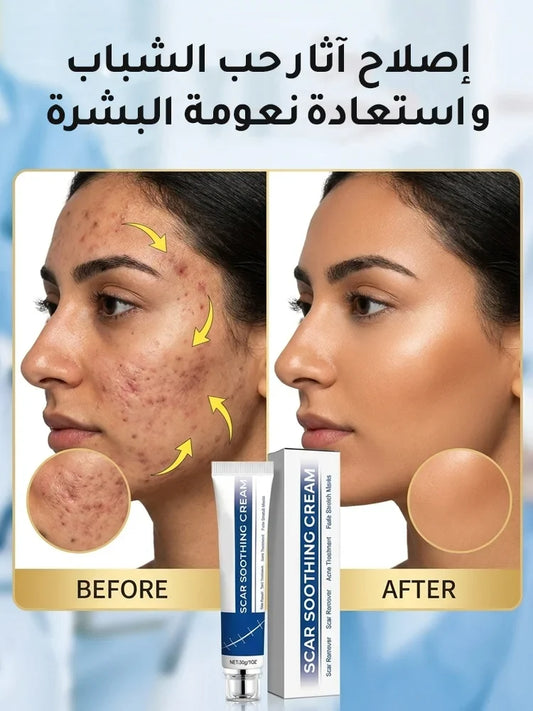 جل السيليكون الطبي لإصلاح الندبات وتخفيف الاحمرار والبروز